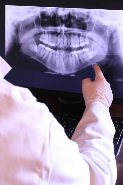 Best Emergency Wisdom Tooth Extraction in Hilton Head Island, SC